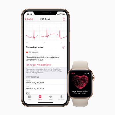 Elettrocardiogramma con Apple Watch?